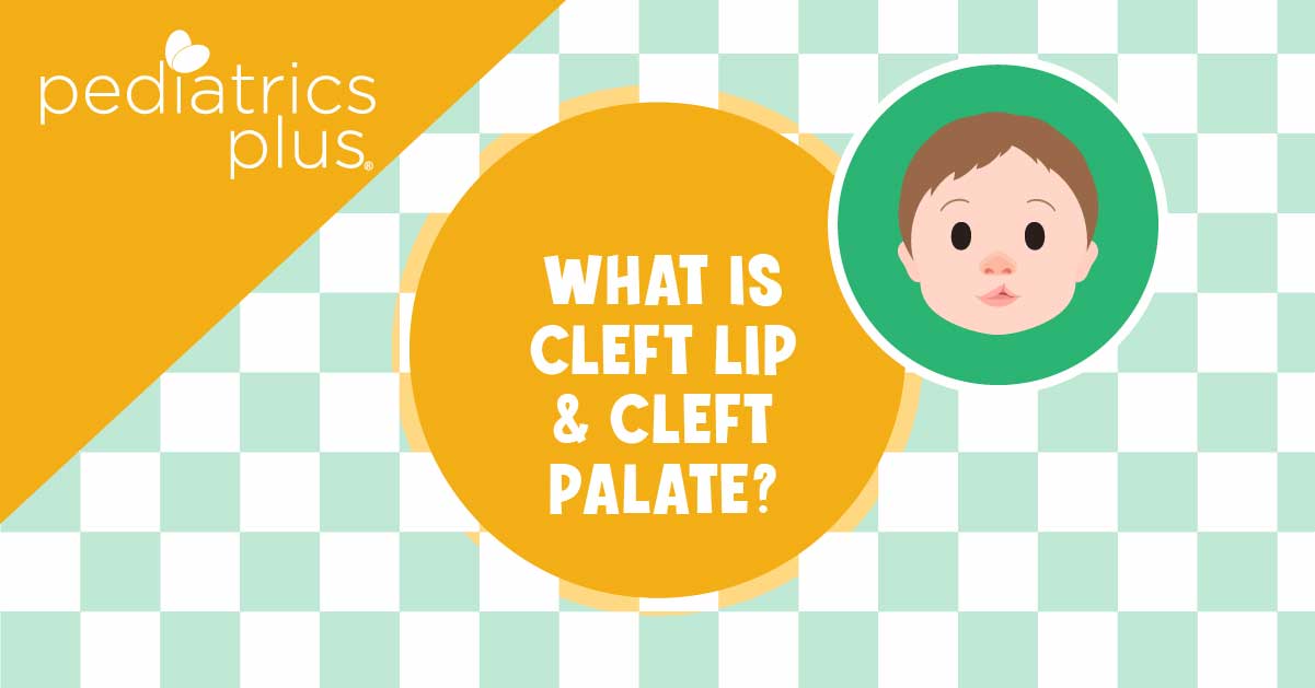 What are Cleft Lip and Cleft Palate?